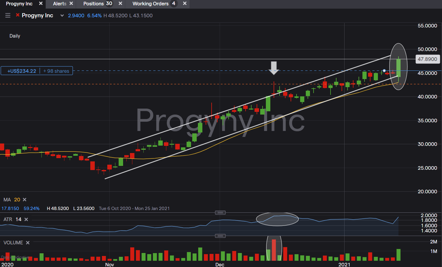 US Stock In Play: $PGNY (Progyny Inc) - @jfsrevg